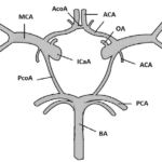 Circle of Willis